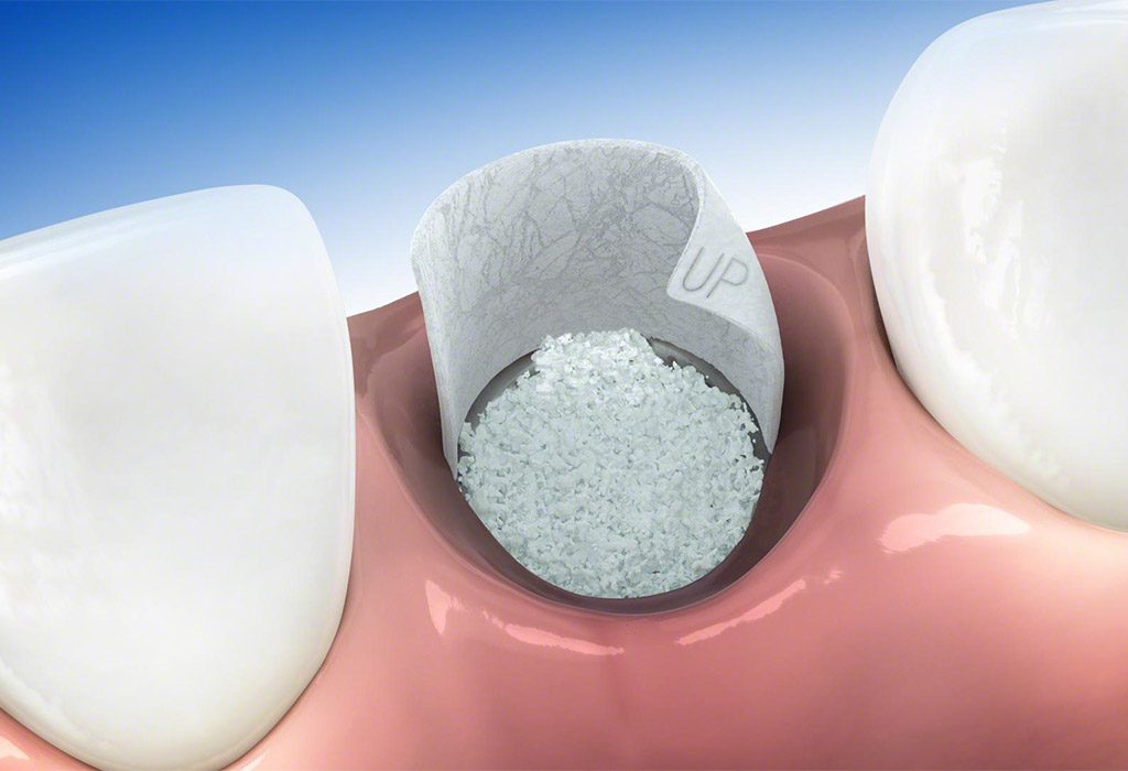 periodoncia en León